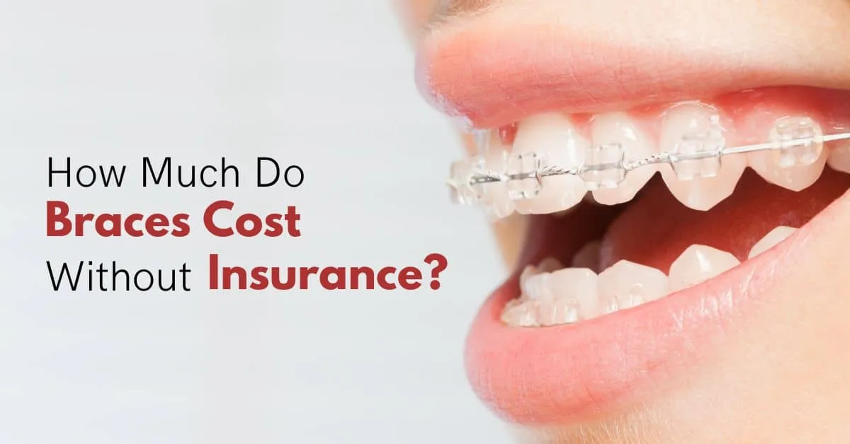How Much Is Braces Without Insurance Full Guide 